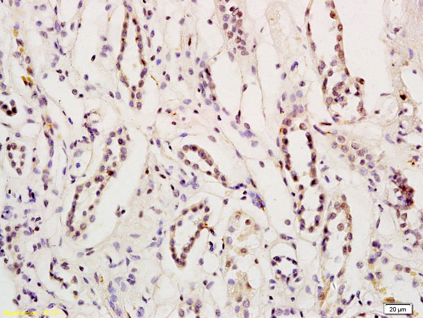 myocardin,促血管平滑肌细胞分化因子抗体